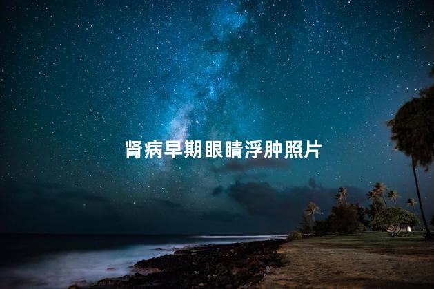 肾病早期眼睛浮肿照片